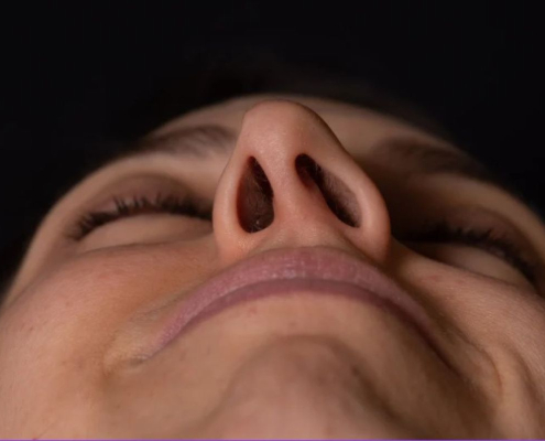 Desvio de septo: sintomas, diagnóstico e quando operar